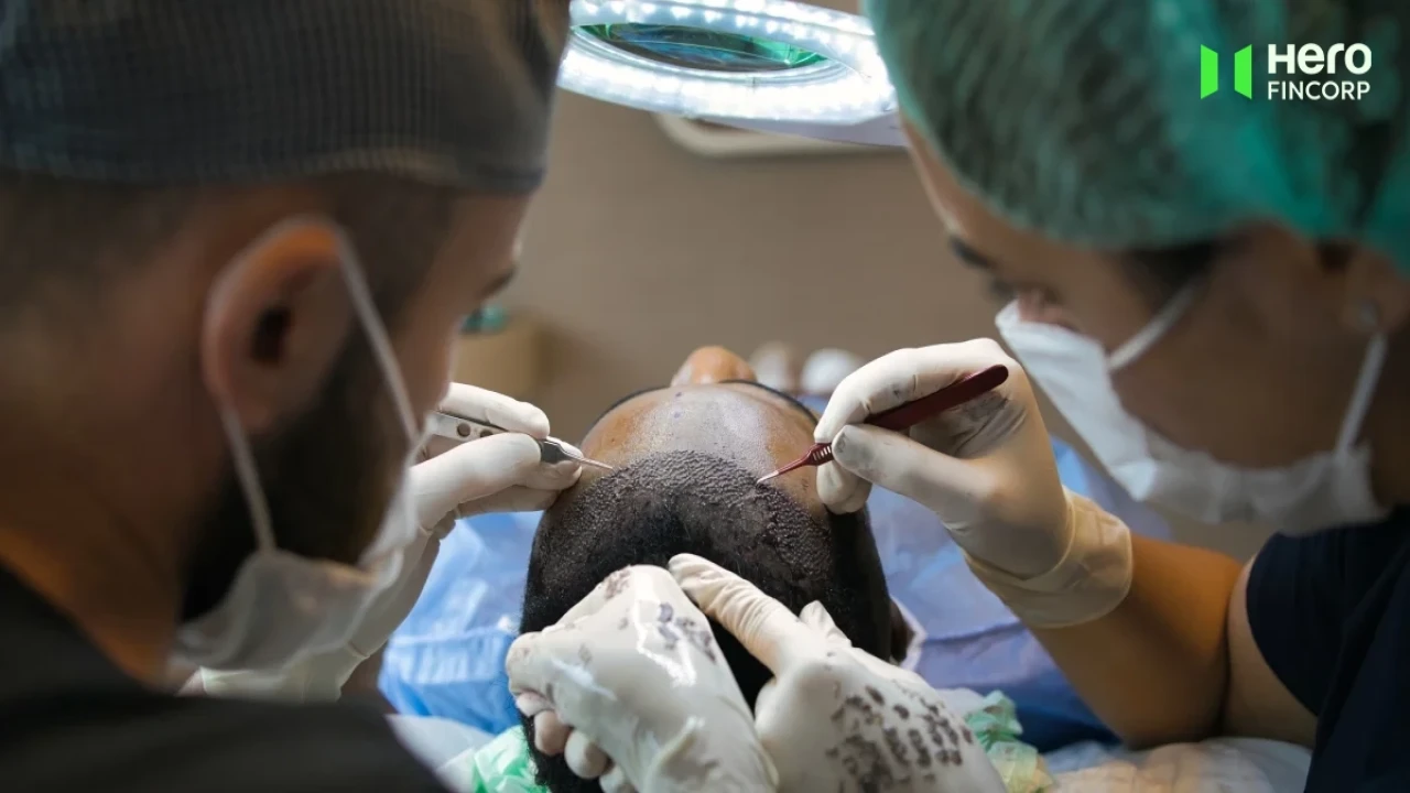 How A Personal Loan Can Help You in Financing Your Hair Transplant Surgery